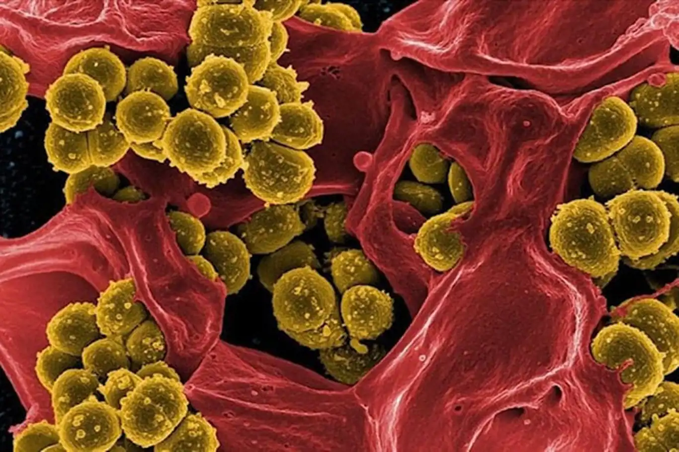 Polonya’da lejyonella bakterisi nedeniyle ölenlerin sayısı 3’e yükseldi