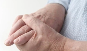 ‘Romatoid Artrit’ nedir ve tedavi yolları nelerdir?