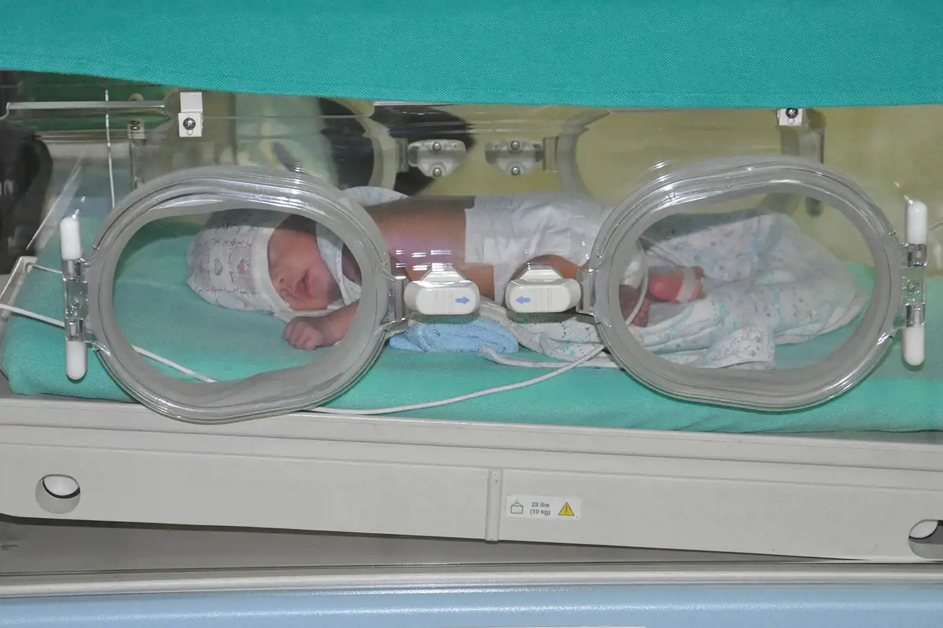 Canlı  doğan her 10 bebekten biri prematüre doğuyor