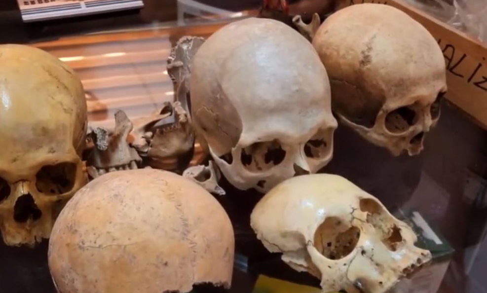 Diyarbakır’da bulunan Orta Çağ dönemi kemikleri kimlere ait?